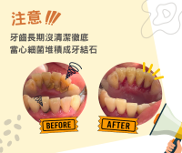 您的牙齒是否有黃黃的、怎麼刷都刷不掉的汙垢呢？