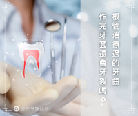 根管治療過的牙齒作完牙套，還會牙裂?