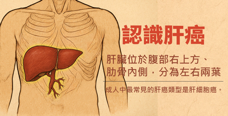 認識肝癌，成人中最常見的肝癌類型是肝細胞癌。