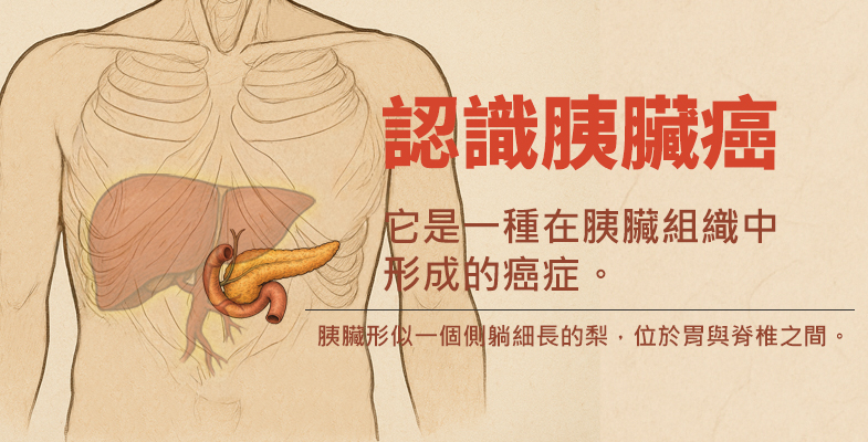 認識胰臟癌，它是是一種在胰臟組織中形成的癌症。