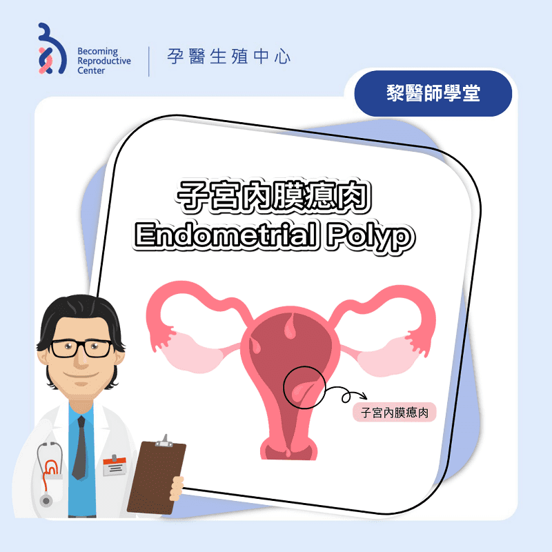 甚麼是子宮內膜瘜肉?