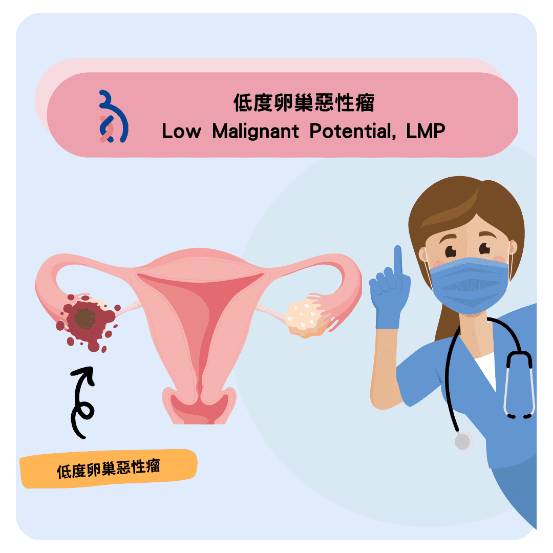 何謂低度卵巢惡性瘤（Low Malignant Potential, LMP）