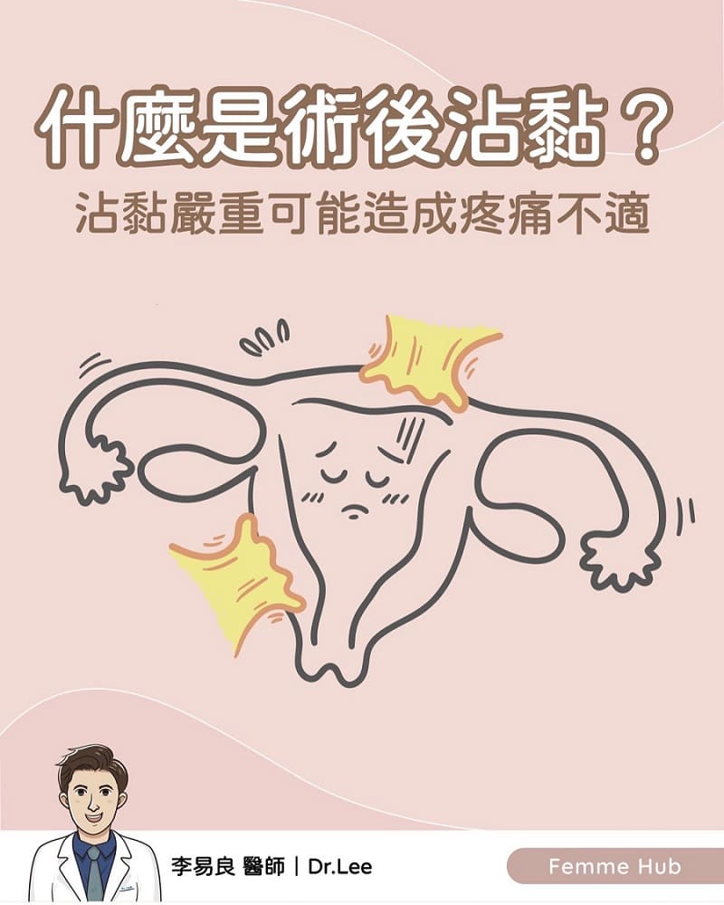 👨🏻‍⚕️為什麼會有手術後沾黏發生⁉️