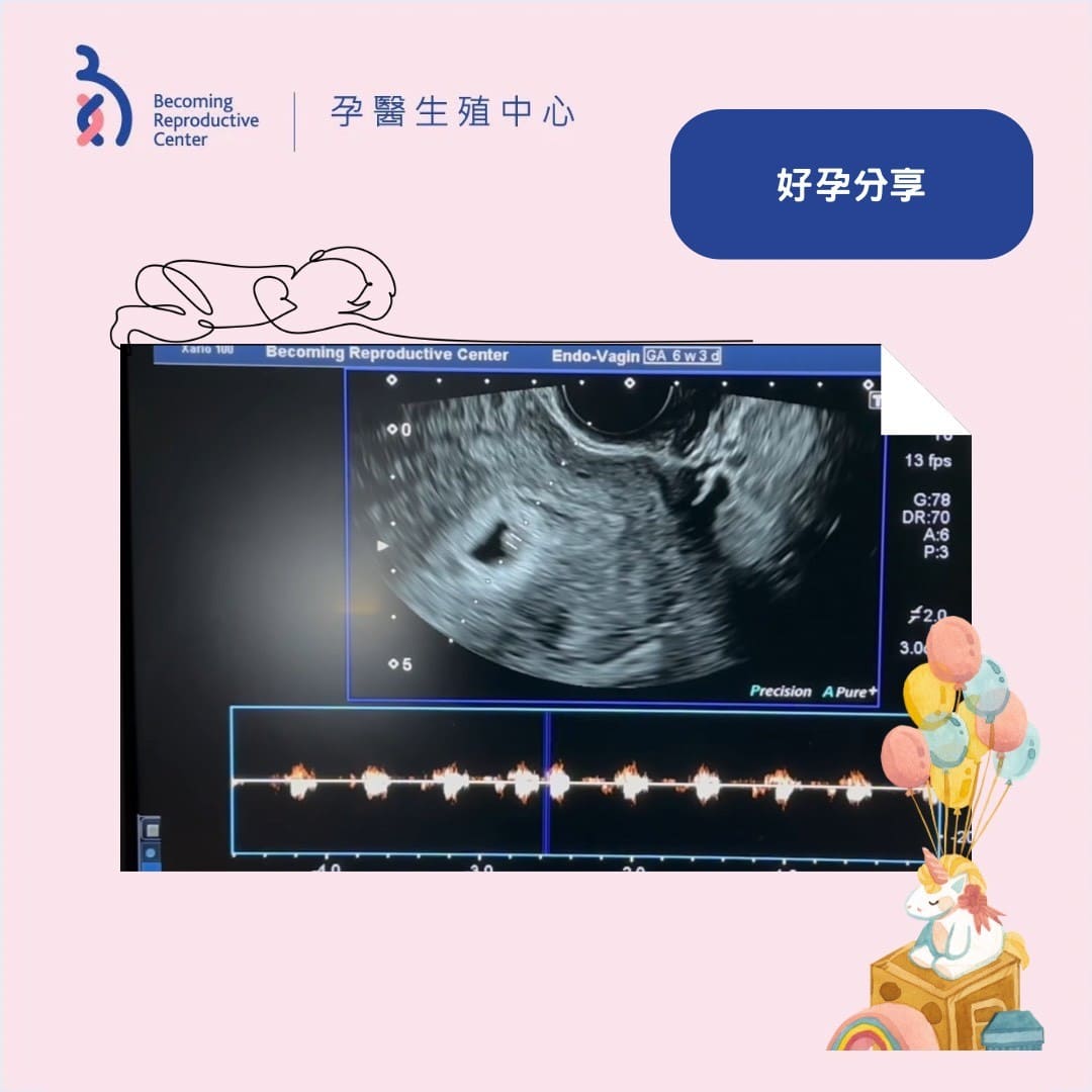 好「孕」成真