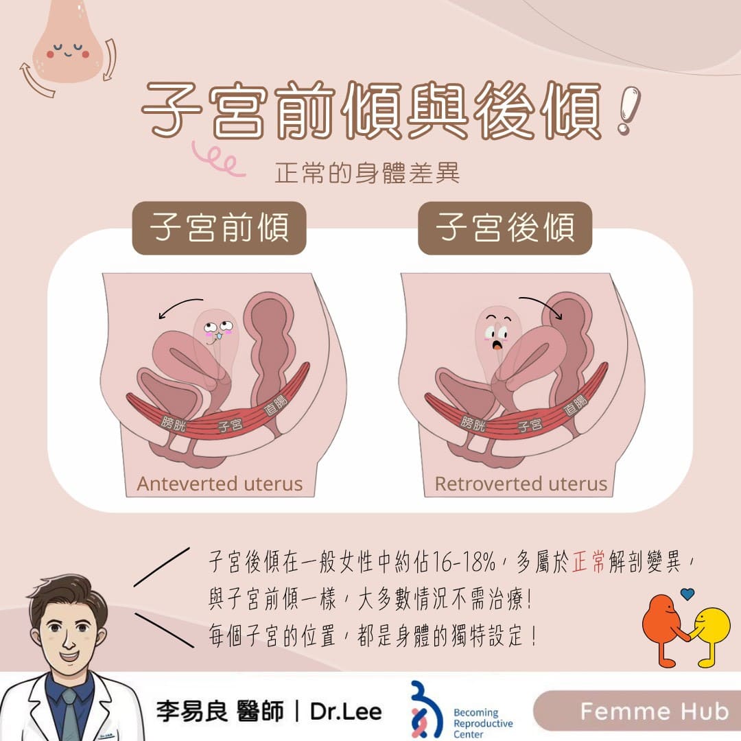 子宮前傾與後傾