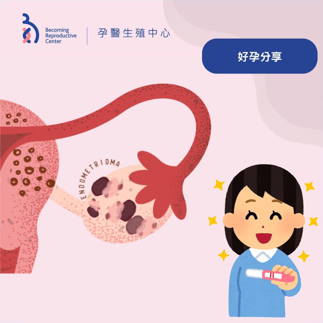 患有腺肌症還有機會懷孕嗎?