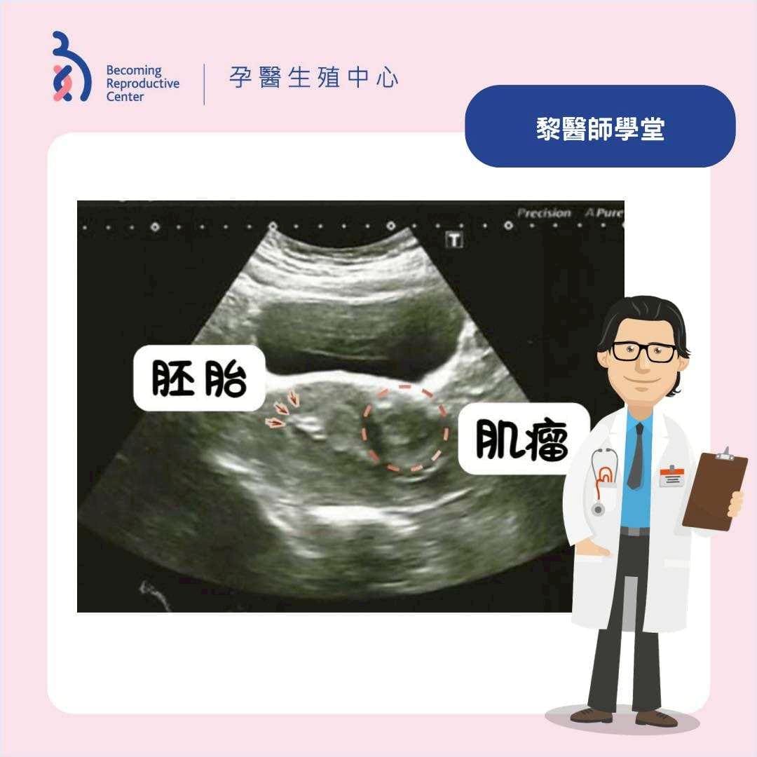 困難植入下的精準胚胎放置