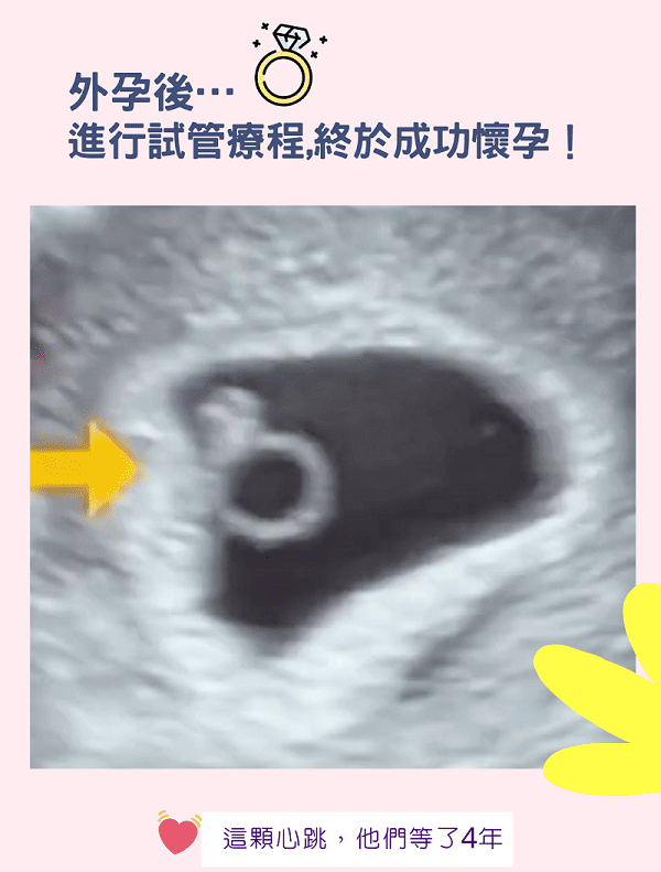 那顆閃閃發亮的小鑽石💎