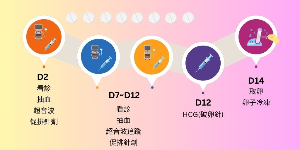 凍卵療程