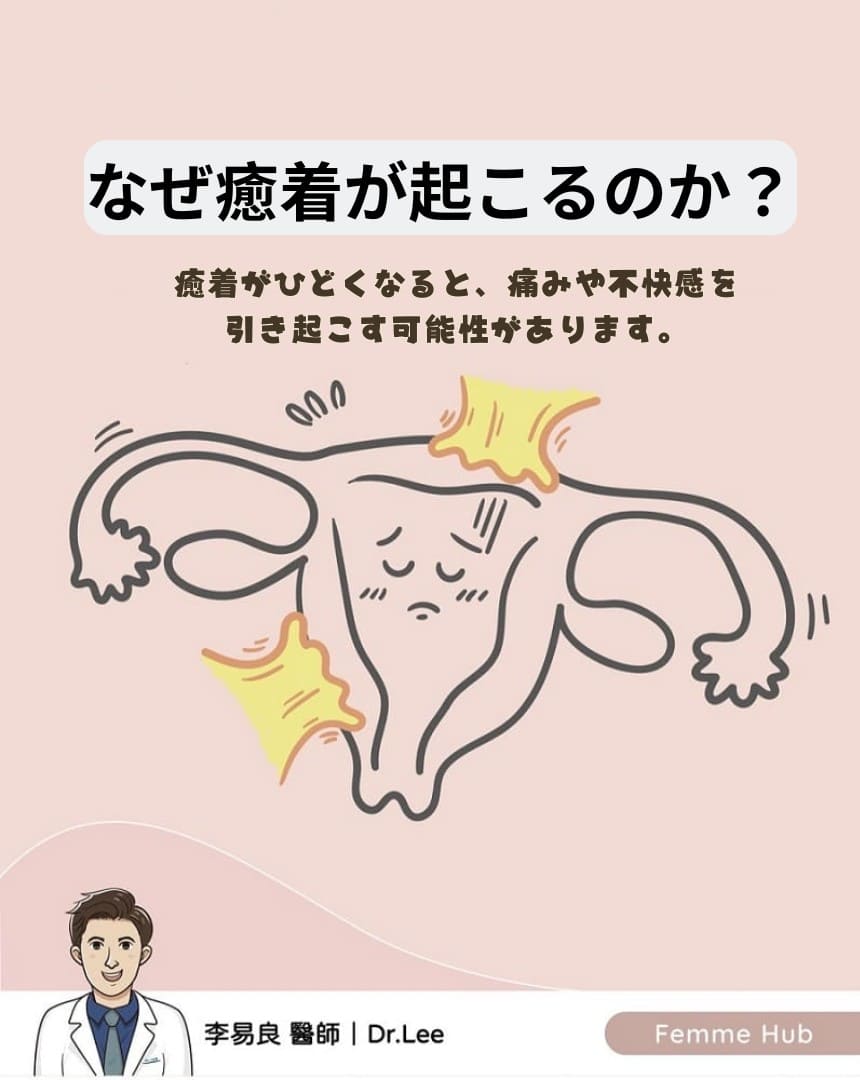 ⚕️なぜ手術の後に癒着が発生するの⁉️