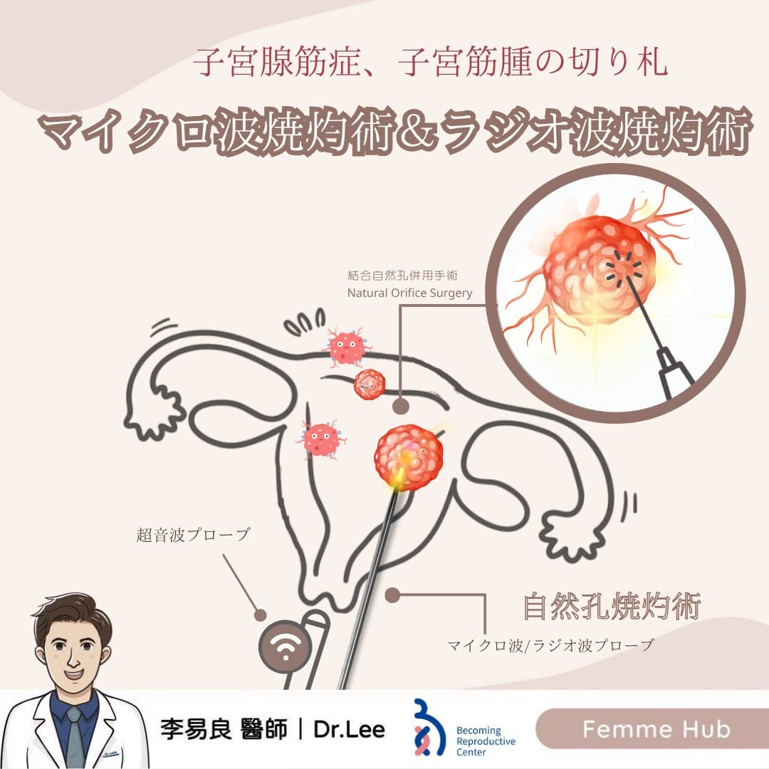 自然孔消融手術：マイクロ波消融 & 高周波消融
