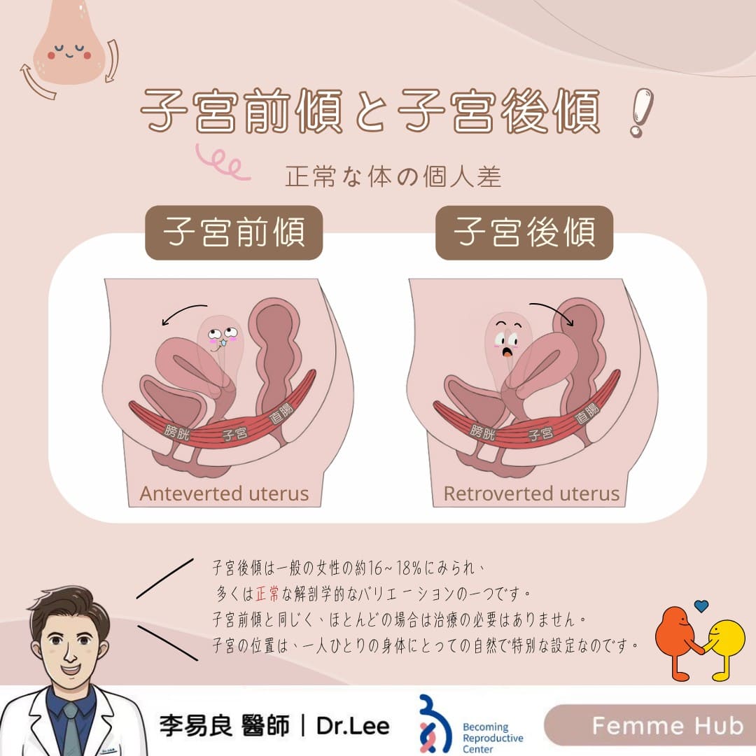子宮前傾 vs 子宮後傾