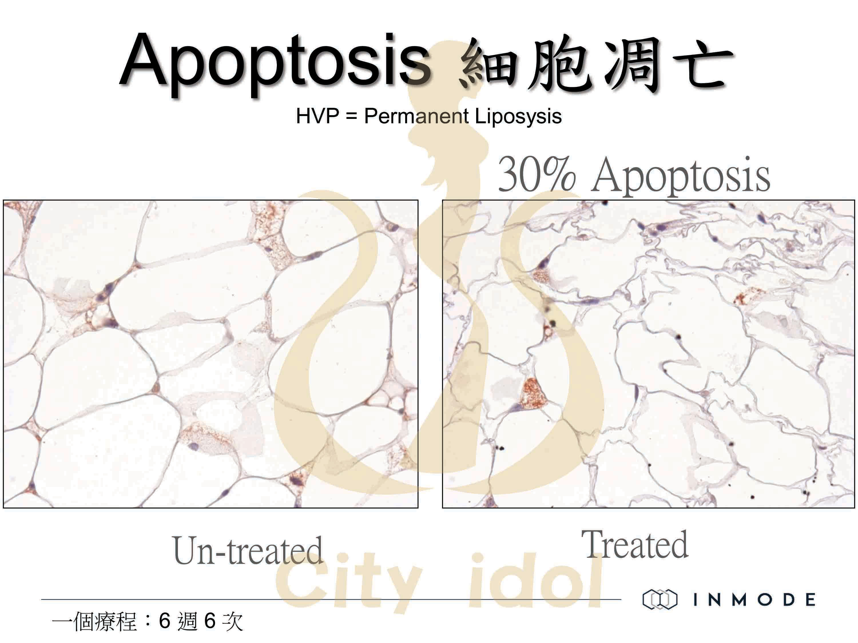 Apoptosis細胞凋亡-1