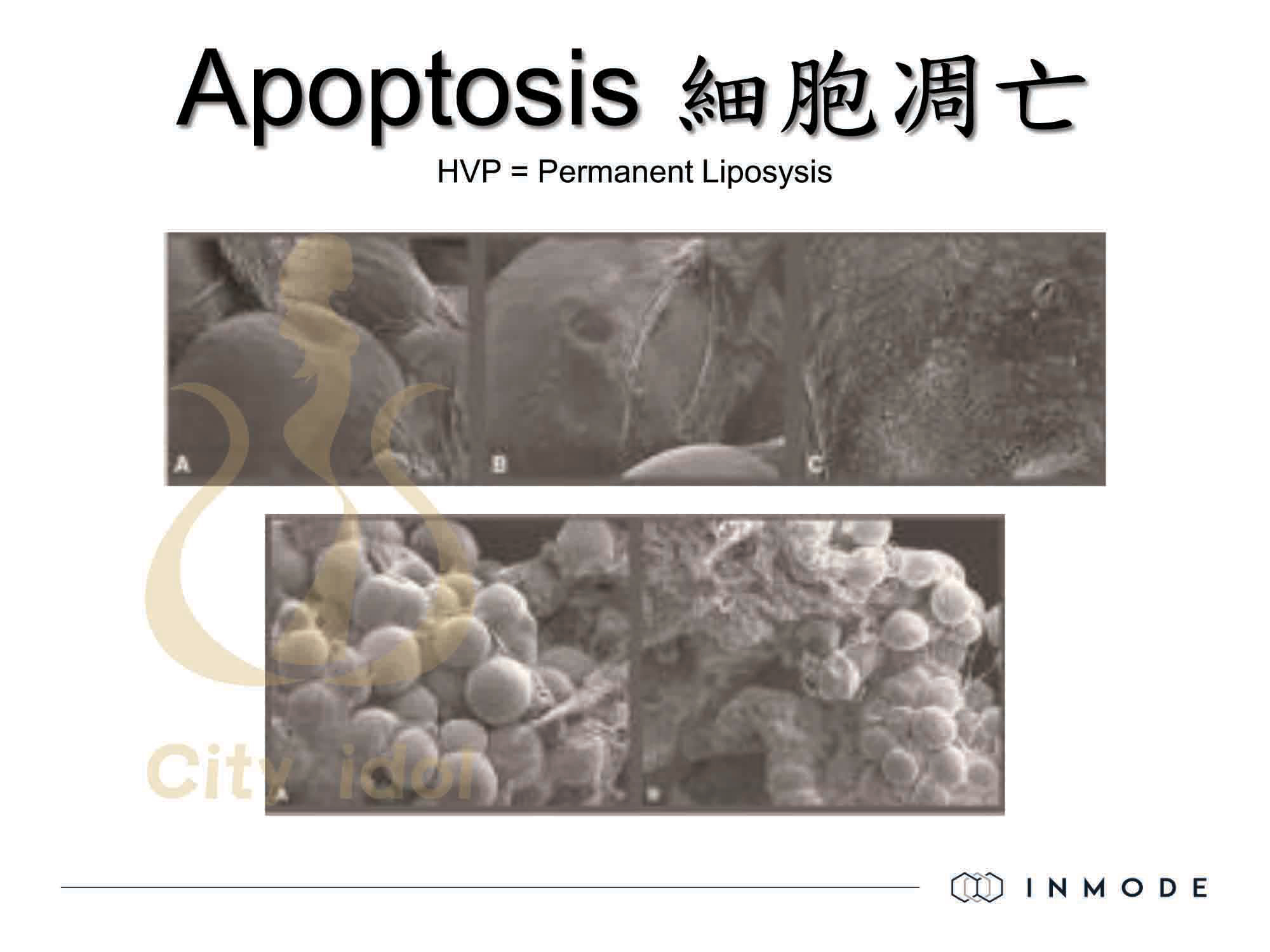 Apoptosis細胞凋亡-2