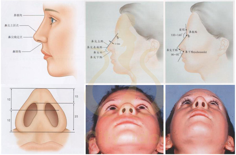 鼻部形態-2