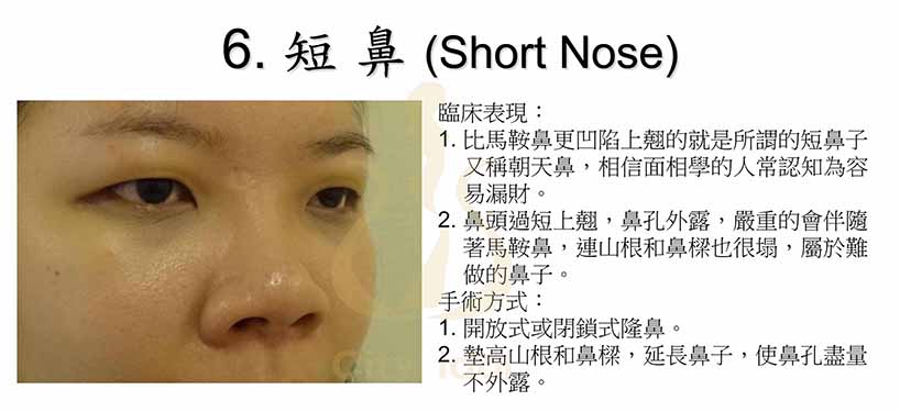 6_短鼻