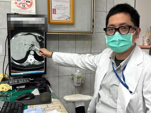 1150122婦嗜好甜食逾六成全是脂肪肝 病變釀成癌示意圖