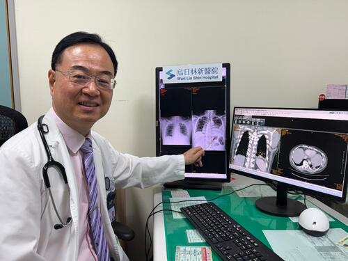 1150612口腔細菌也會侵肺！52歲男胸痛就醫1天半惡化成罕見膿胸 微小微單胞菌作怪 歷經肋膜腔插管引流並手術清創痊癒示意圖