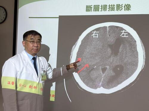1150615忙到半邊無力！攤商端節前「亞急性腦出血」 醫籲3徵兆快就醫示意圖