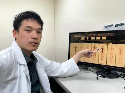 1150819癌細胞轉移骨頭痛到睡不著！ 精準「鐳」擊帶攝護腺癌患者減痛又延命 骨轉移不再只能靠止痛藥　醫：核醫治療帶來新希望示意圖