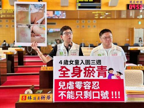1150820四歲女童入園三週全身瘀青 議員林祈烽怒批中市府縱容四天 教育局：掌握相關佐證展開調查示意圖