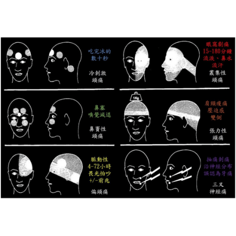 【耳鼻喉】頭痛還是偏頭痛